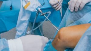 Knee Arthroscopy in Ludhiana | Punjab | Moga | Mullanpur | Malerkotla