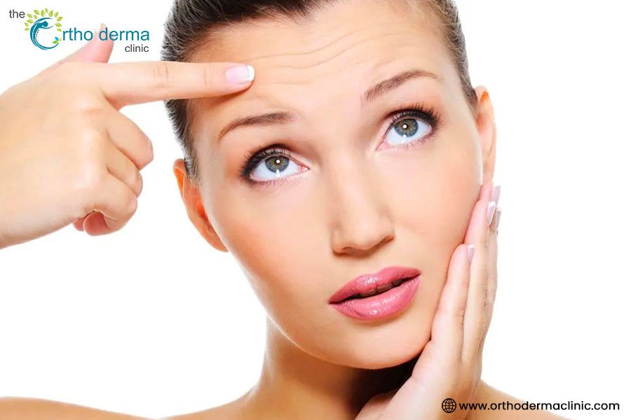 Forehead wrinkles Treatment | Orthoderma Clinic