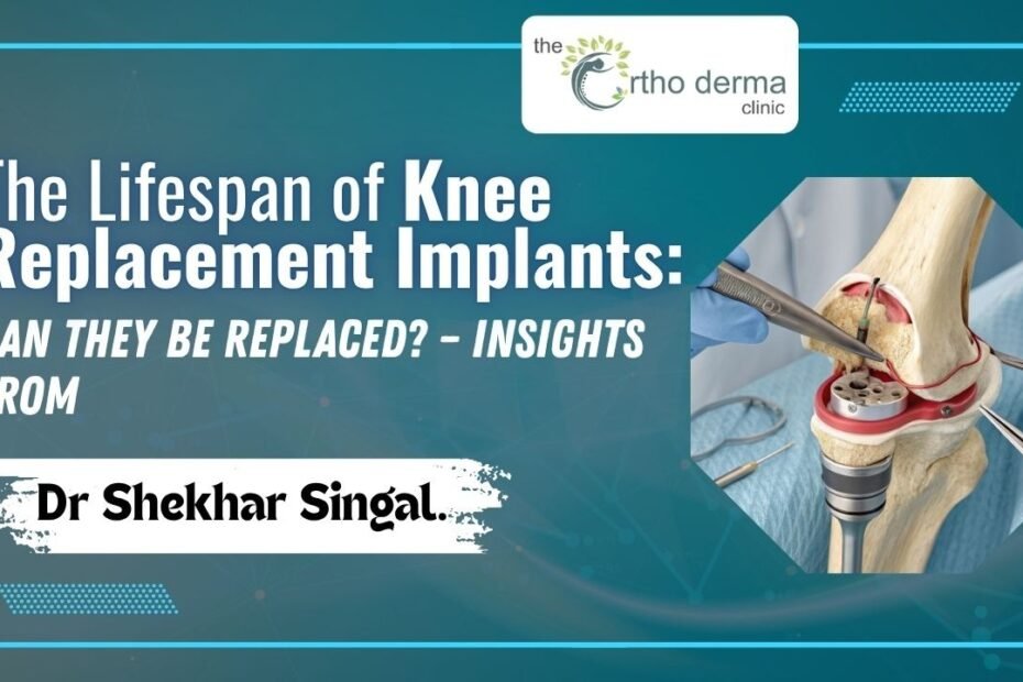 an image of a surgical model showing a knee joint implant procedure