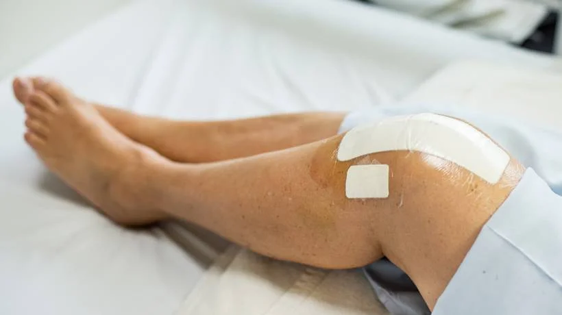 Knee Replacement Surgery in Ludhiana | Orthoderma Clinic