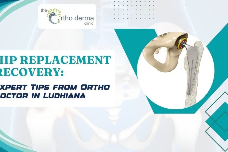 a 3D medical illustration of a hip joint with an artificial implant representing hip replacement surgery