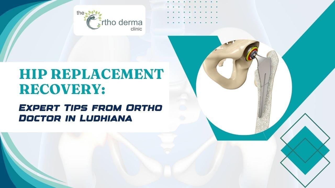 Hip Replacement