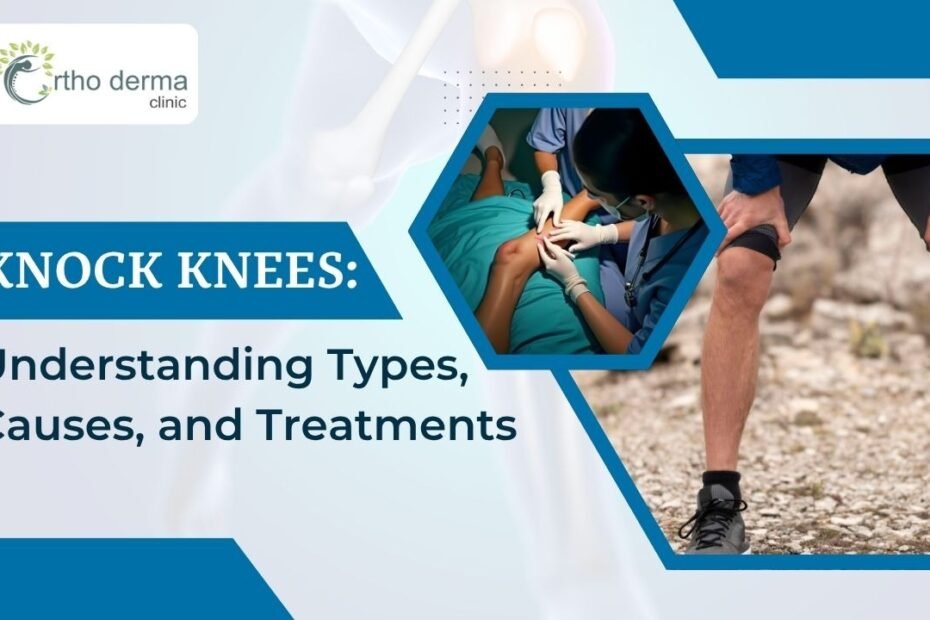 a person with bent knees and medical professionals examining a patient’s leg in a clinical setting