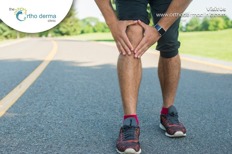 Knock knees | Orthoderma Clinic