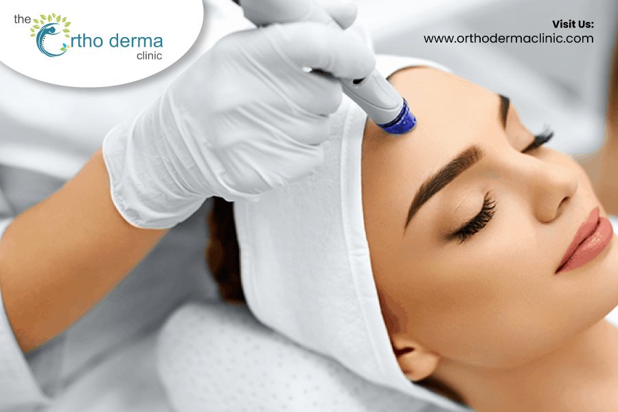 Benefits of Hydra Facial | Orthoderma Clinic