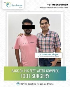 Back on his feet after a complex foot surgery. Here’s to a future full of strong strides. DM- WhatsApp 9856900169 to book your #orthopedicappointment.#orthodermaclinic #drshekharsingal #KneeReplacem