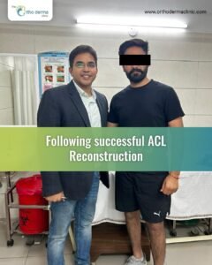 Empowering progress post-ACL reconstruction. Witnessing our patient’s resilience firsthand is truly inspiring. DM- WhatsApp 9856900169 to book your #orthopedicappointment. Orthoderma Clinic, K3-95, K