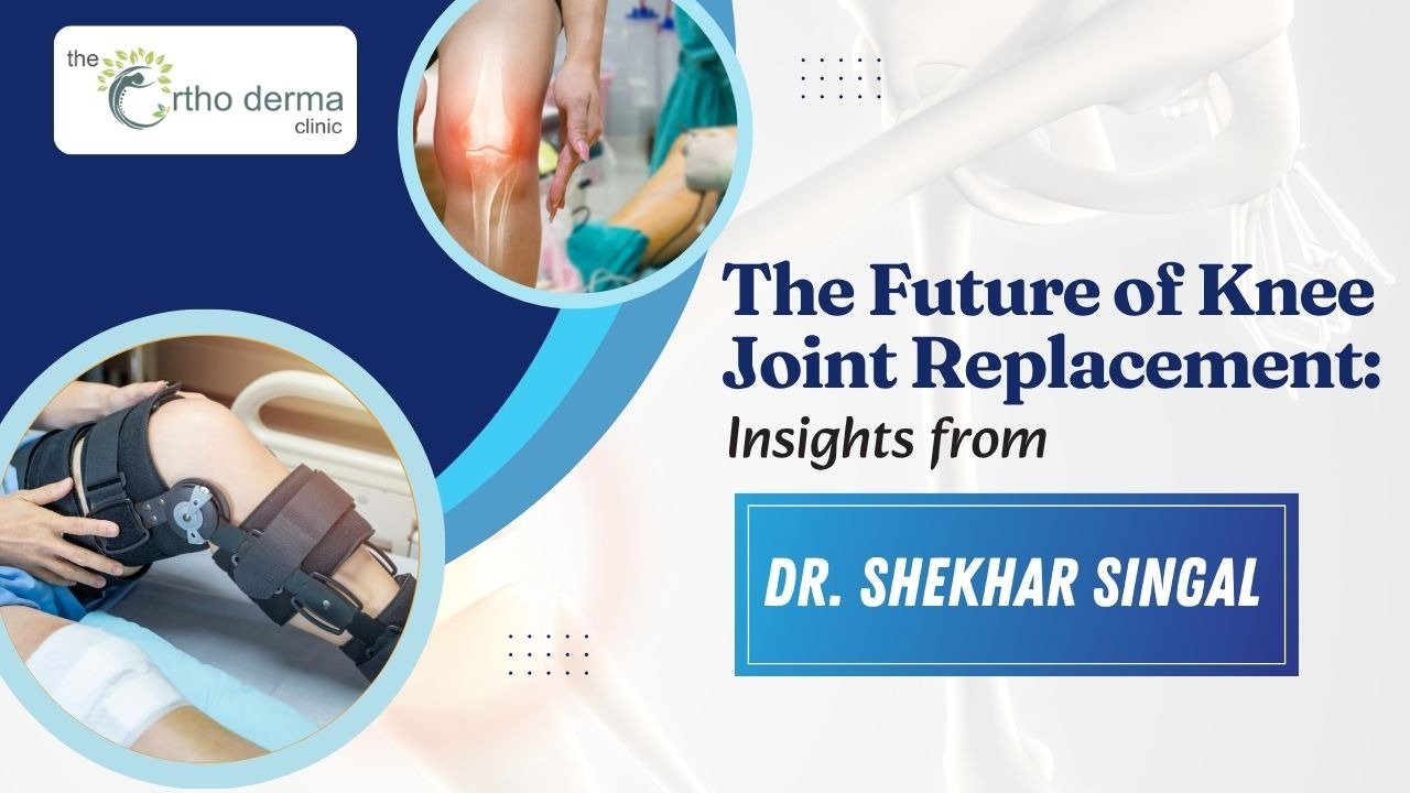 Knee Joint Replacement