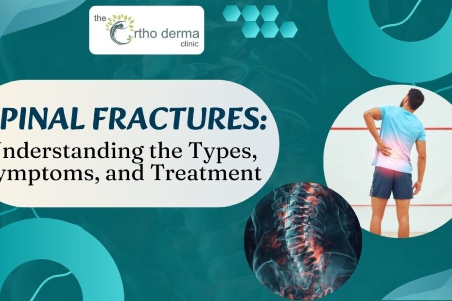 a man holding his lower back in pain and a medical illustration of a spine with highlighted fracture areas