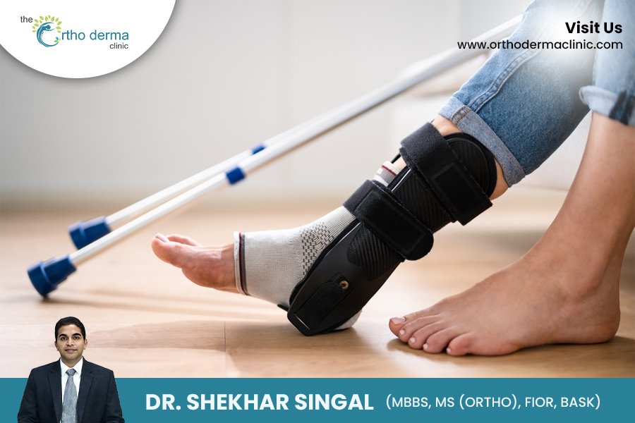 Foot and Ankle Surgery | Dr. Shekhar Singal