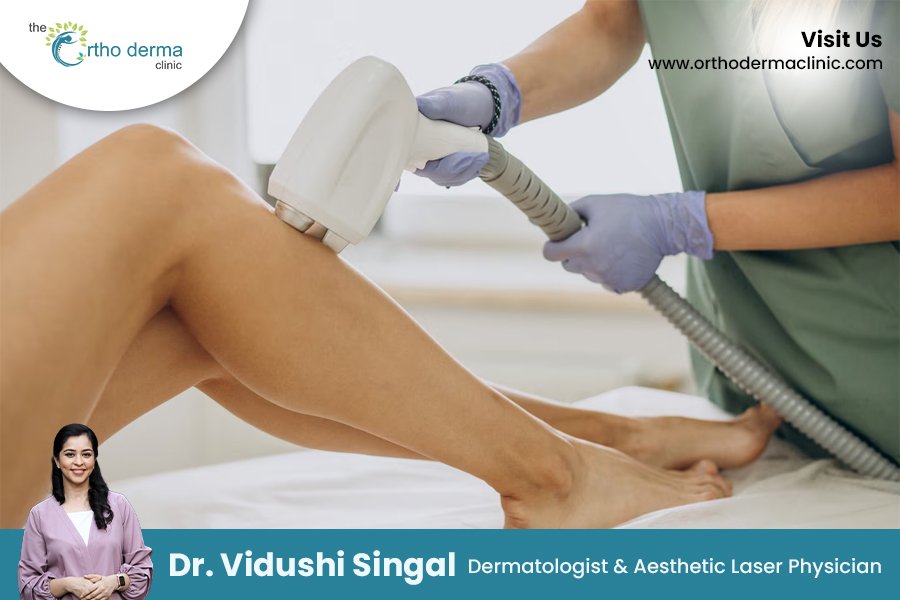 Laser hair removal | Orthoderma Clinic