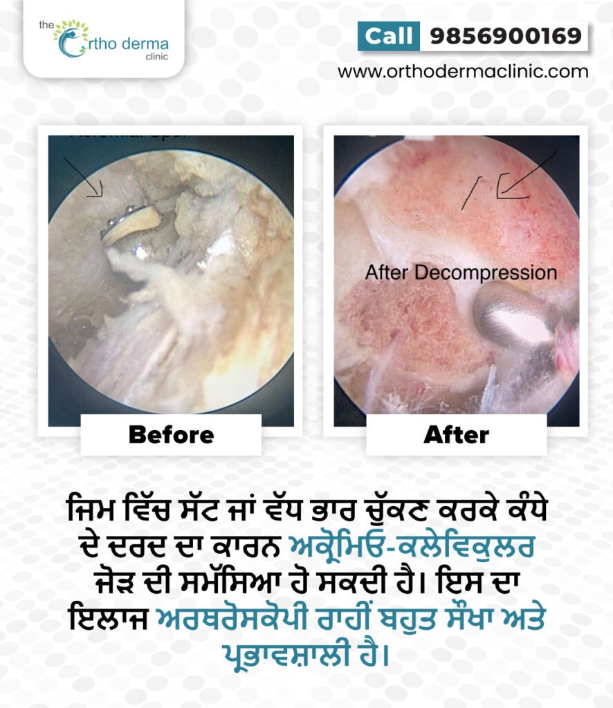 Before and after of knee replacement surgery | Orthoderma Clinic