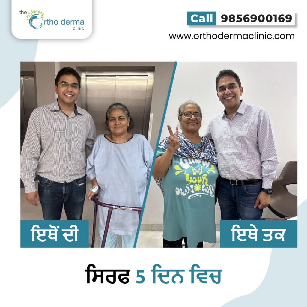 Knee Replacement Surgery Ludhiana | Orthoderma Clinic