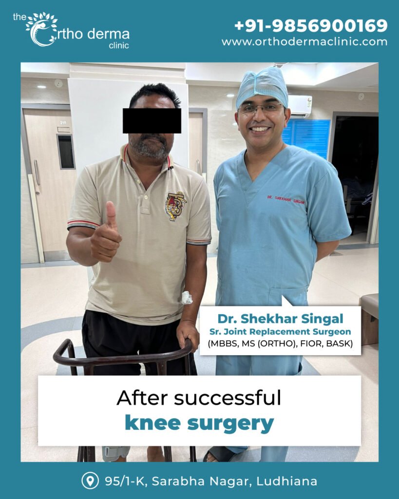 Successful Knee Replacement Surgery in Ludhiana | Orthoderma Clinic