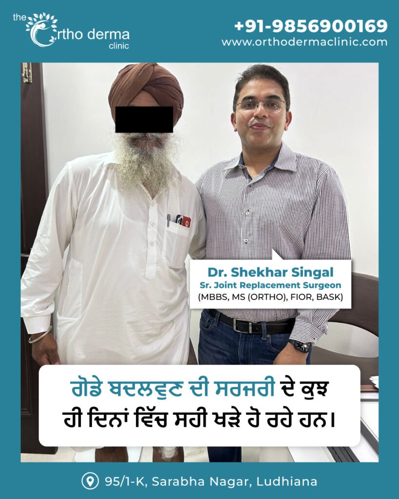 Knee Replacement Surgery Ludhiana | Orthoderma Clinic