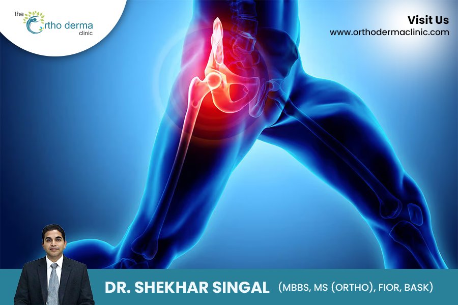 Advancements in Hip Surgery | Orthoderma Clinic