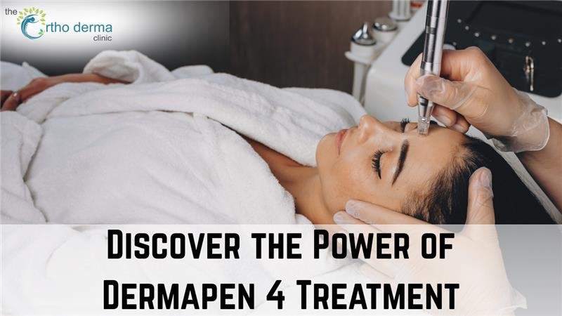 Woman lying down with eyes closed receiving Dermapen 4 treatment on forehead