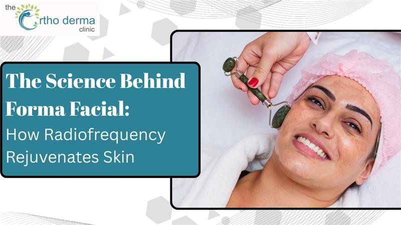 Woman smiling while receiving radiofrequency facial treatment with text "The Science Behind Forma Facial: How Radiofrequency Rejuvenates Skin" by The Ortho Derma Clinic.