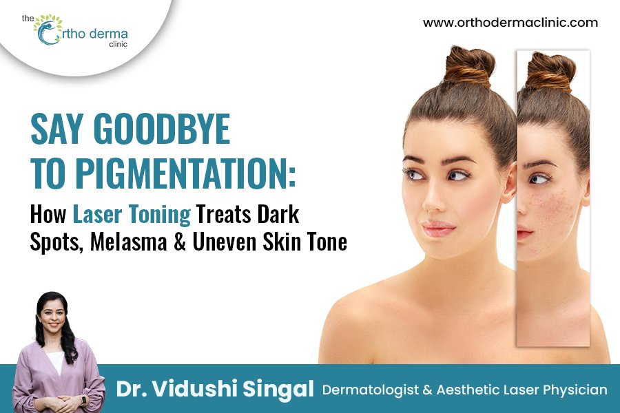 Laser toning treatment for pigmentation