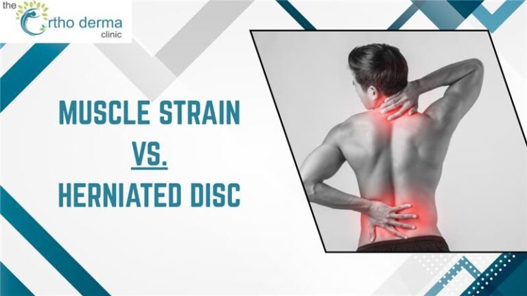 How to Treat Muscle Strain vs. Herniated Disc Effectively» Orthodermaclinic