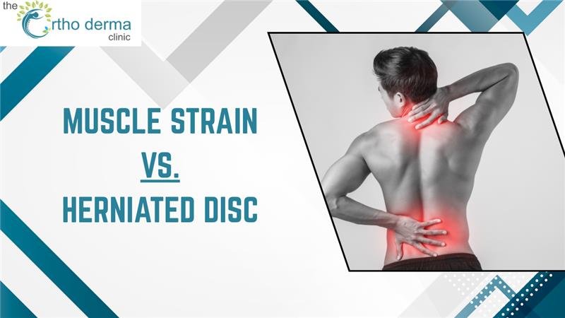 Muscle Strain vs. Herniated Disc