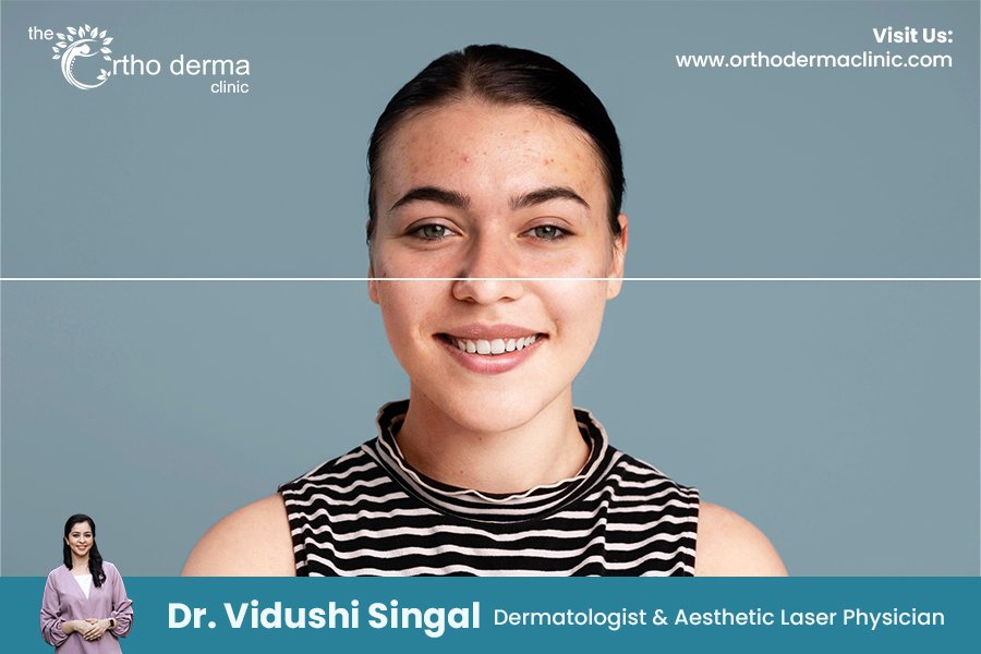 Pigmentation Problems in Indian Skin
