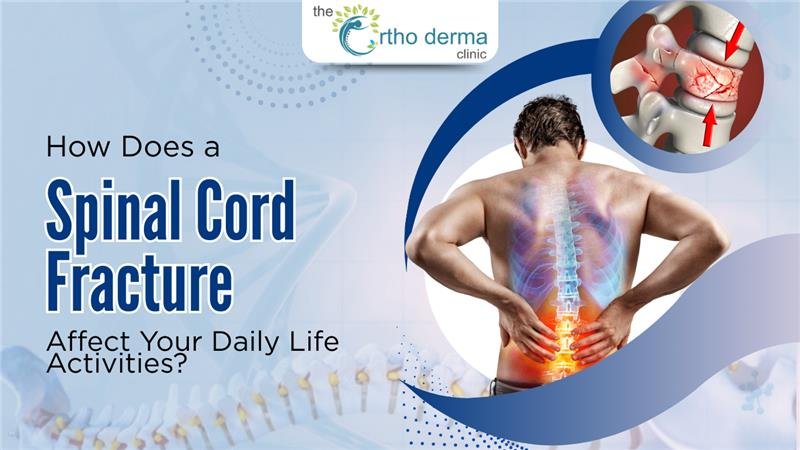spinal Cord Fracture Affect
