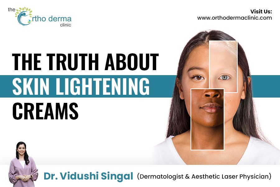 Skin lightening creams facts and myths explained