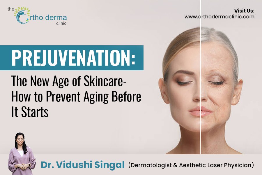 Prejuvenation