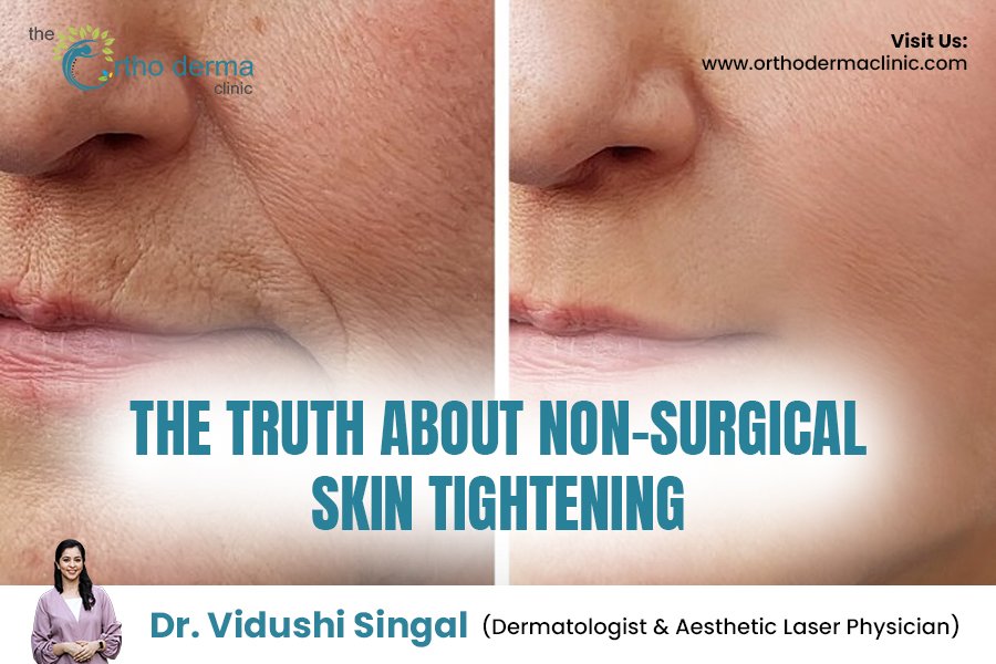 Non-Surgical Skin Tightening