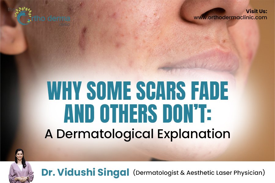 Why Some Scars Fade and Others Don’t